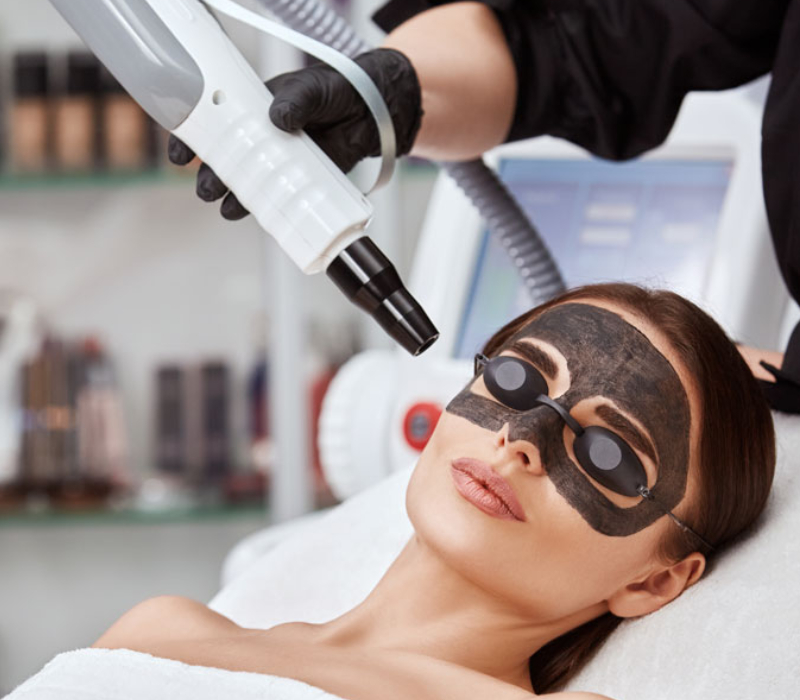 Carbon Laser Hydrafacial